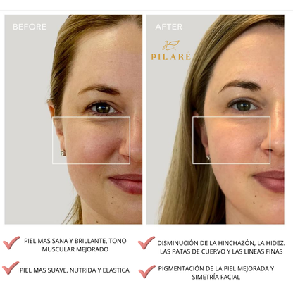 FACIAL MICRO CORRIENTE - MASAGEADOR REAFIRMANTE